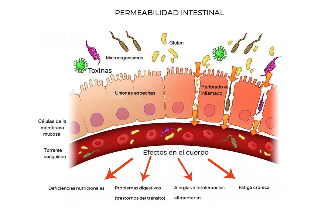 permeabilidad intestinal causas tratamientos 1